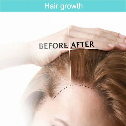 RenovaGlow Red LED, Laser Cap